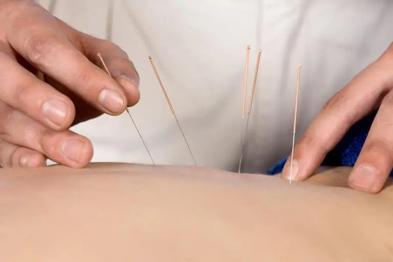5 Reasons to Try Dry Needling For Pain Relief